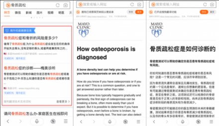 骨質(zhì)疏松你真的了解嗎？搜狗搜索教你正確守護骨骼健康