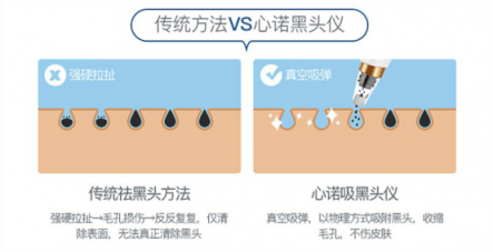 雙11最值得入手的面部清潔電器！美國心諾黑頭儀價格直降一半！