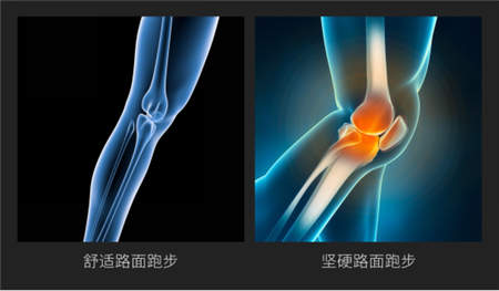 小米眾籌首款智能折疊跑步機(jī)開售，價格爆低僅相當(dāng)于一雙跑鞋