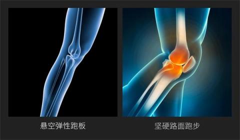 小米眾籌首款智能折疊跑步機來襲，讓愛跑步的人有“地”放矢