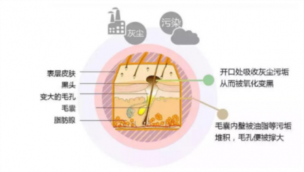 讓你的黑頭全退散！黑頭儀有用嗎？