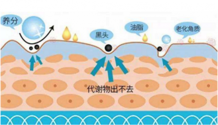 去掉黑頭你就是下一個(gè)林志玲！黑頭儀哪個(gè)牌子好？