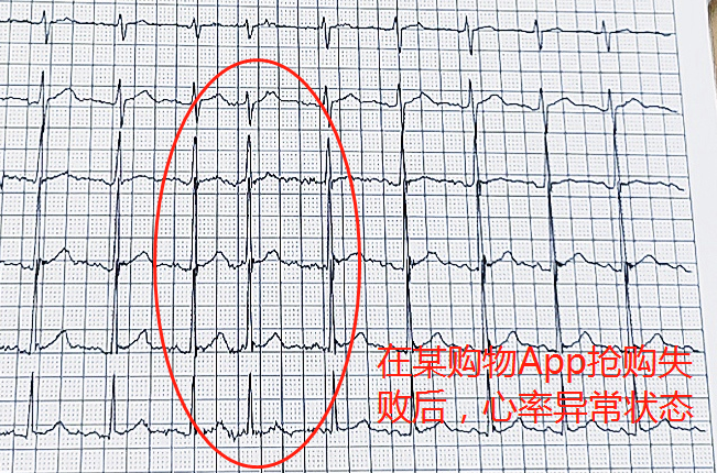 618網購致老人多次心率異常 ?醫(yī)生提示要選有保障的網購平臺