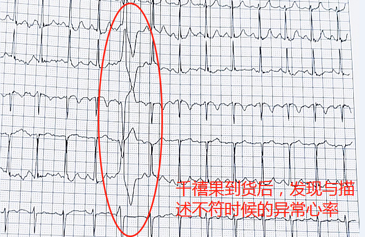 618網購致老人多次心率異常 ?醫(yī)生提示要選有保障的網購平臺