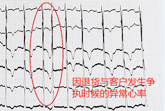 618網購致老人多次心率異常 ?醫(yī)生提示要選有保障的網購平臺