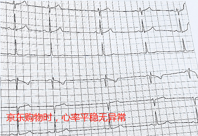 618網購致老人多次心率異常 ?醫(yī)生提示要選有保障的網購平臺