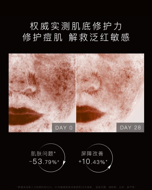 挑戰(zhàn)7天強(qiáng)韌修護(hù)肌底HomeFacialPro黑標(biāo)系列基底修護(hù)精華液震撼上市