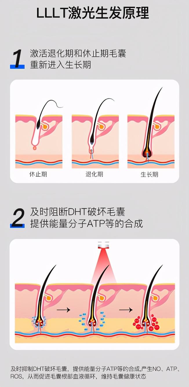 LLLT低能量激光生發(fā)儀，內(nèi)置81顆激光器