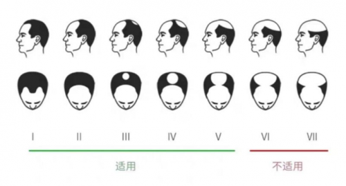 小米眾籌銷量驚人的可思美激光生發(fā)帽，真的能生發(fā)嗎？