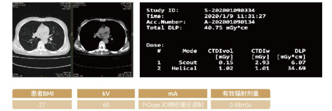 開影Precision 128精密斷層能譜CT獲得NMPA注冊證