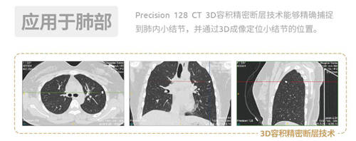 開影Precision 128精密斷層能譜CT獲得NMPA注冊證