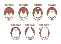 2.5億人被脫發(fā)困擾？Rogaine培健實(shí)力生發(fā)