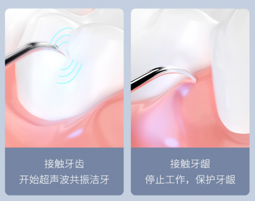 年輕人愛(ài)美從牙齒開(kāi)始，這款199的口腔護(hù)理神器太值了，買(mǎi)它！