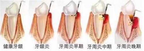 小米有品眾籌超10000000！素諾智能可視潔牙儀T11Pro為何一炮而紅？