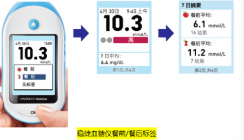 哪個牌子血糖儀好？為何穩(wěn)捷獨得老百姓的寵愛？