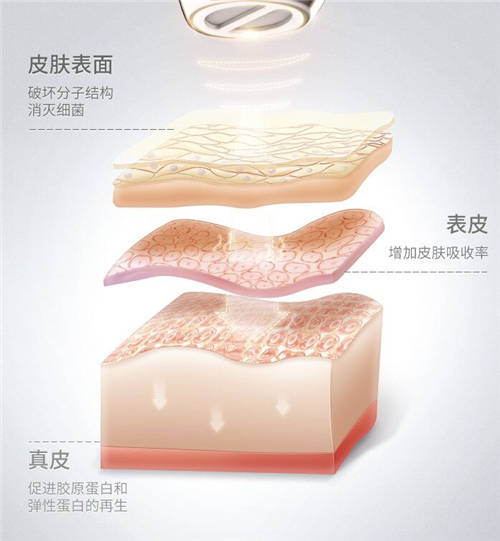 COSBEAUTY可思美專注研發(fā)，新品等離子凈膚儀憑實力圈粉