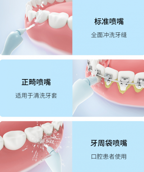 正畸人士福音！素諾智能可視沖牙器C3 pro看得清，沖得凈