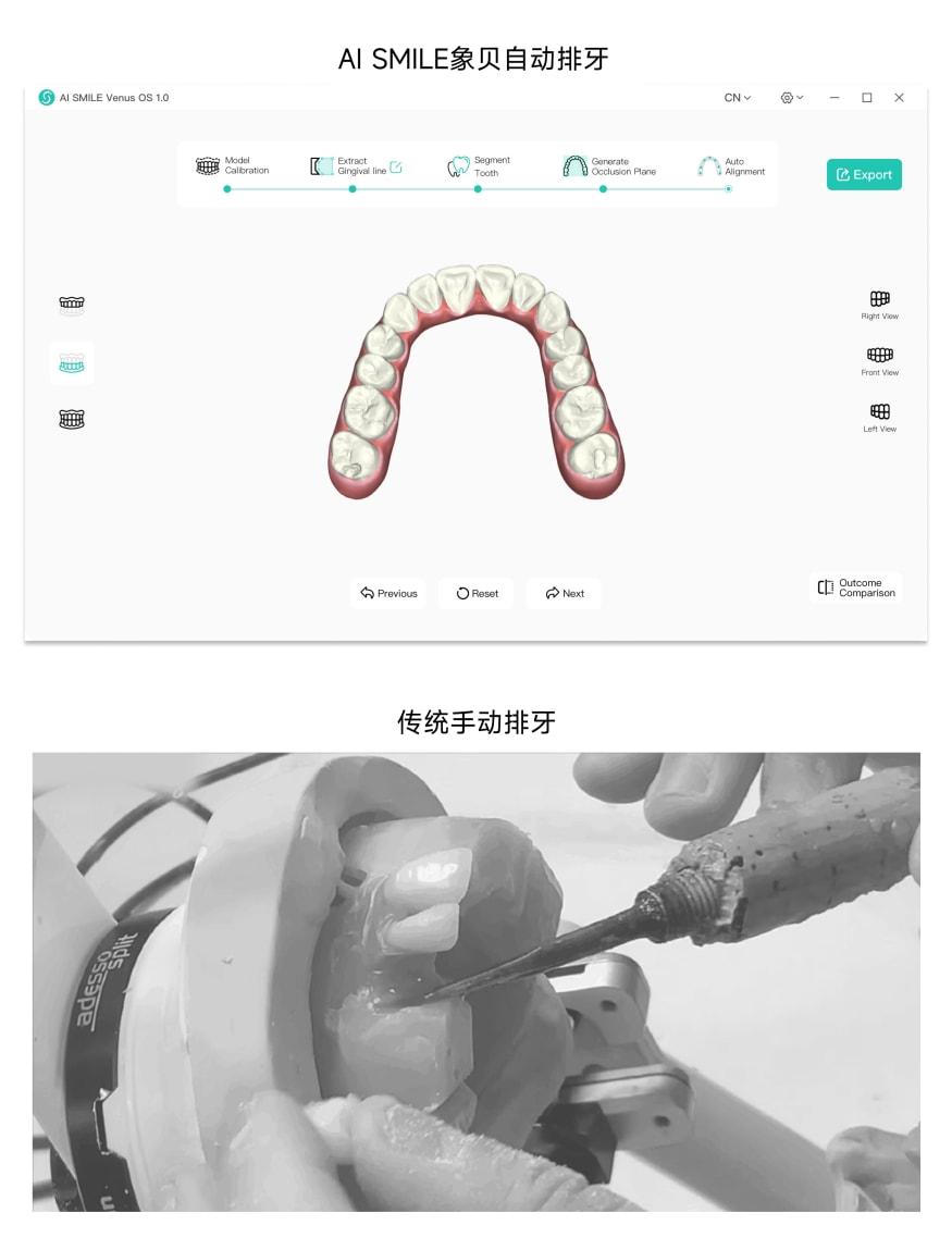 獨角獸地位盡顯！象貝AI正畸排牙系統(tǒng)Venus1.0發(fā)布 開辟數(shù)字化牙科新紀(jì)元