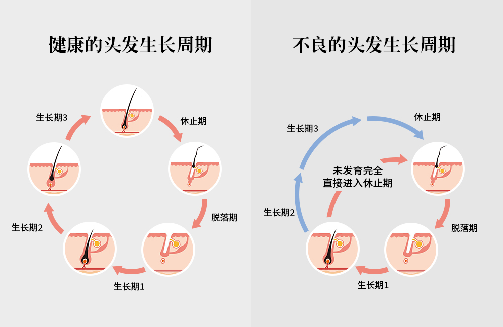 拯救頭頂大事，采用創(chuàng)新配方REDENICAL的DR ZERO來到中國