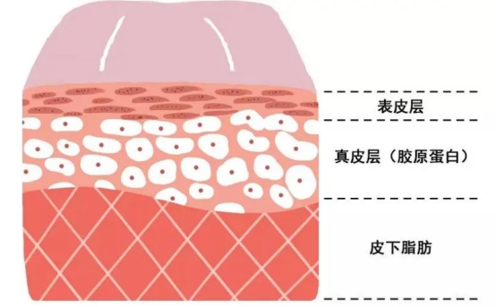 不做表面功夫，潤(rùn)致娃娃針+分層抗衰讓你年齡滿(mǎn)40減20